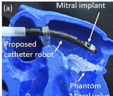 Figure — Design and Control of 5-DoF Robotically Steerable Catheter for the Delivery of the Mitral Valve Implant
