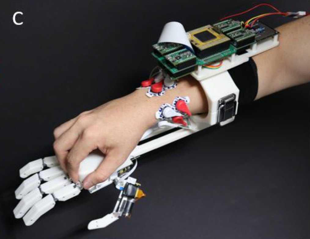 The MSC Prosthetic Hand: Rapid, Powerful, and Intuitive
