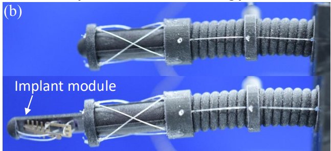 Figure — Towards the Development of a Robotic Transcatheter Delivery System for Mitral Valve Implant